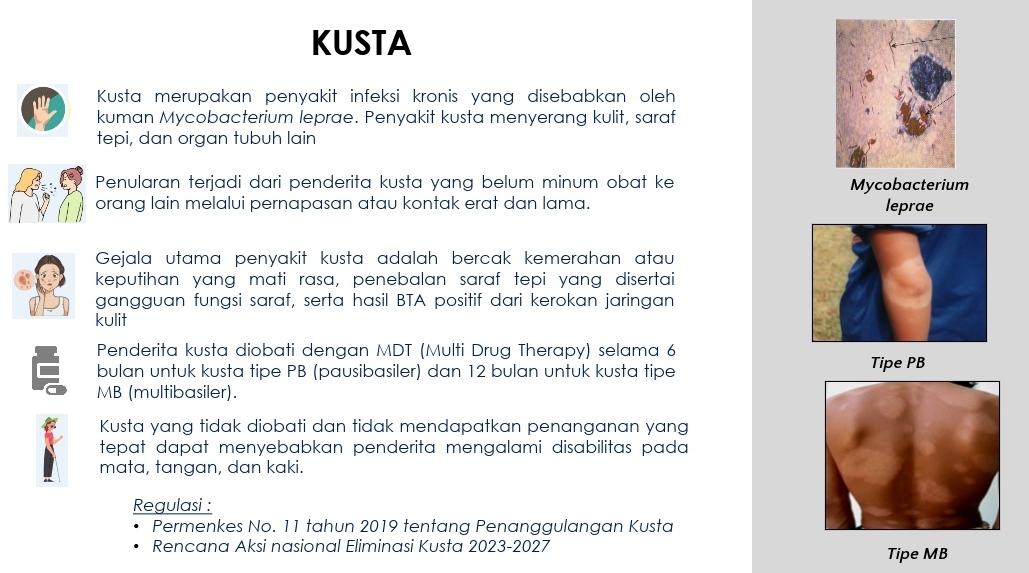 BGN Tunggu Hasil Pemeriksaan Sampel dari BPOM soal 140 Siswa Kupang Keracunan